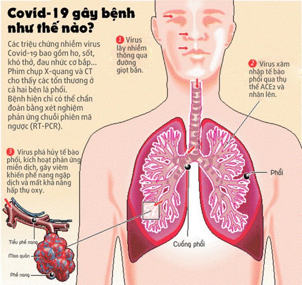 Đối với hầu hết bệnh nhân, virus corona bắt đầu lây nhiễm và gây ra những tổn hại nặng nề nhất bên trong hai lá phổi của họ. Bởi suy cho cùng cũng giống như cúm, Covid-19 là một bệnh đường hô hấp.