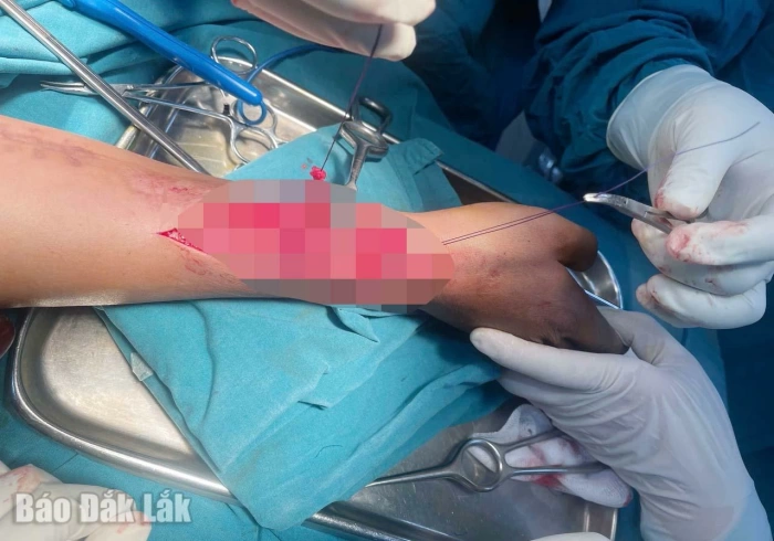 Bác sĩ Bệnh viện Đa khoa Phú Yên phẫu thuật chuyển gân cứu sống bàn tay 