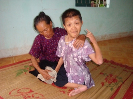 Bà Hoàng Thị Chư (thôn 6, xã Ea Phê, huyện Ea Kar) đang chăm sóc cho đứa con kém may mắn